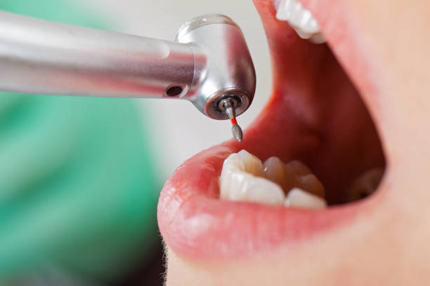Best Walk-In Emergency Dentist in Desert Edge, CA